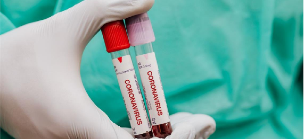 Coronavirus, i deceduti hanno un'età media di 80 anni e patologie pregresse