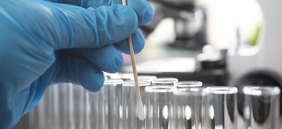 Coronavirus, i test antigenici rapidi si possono effettuare negli studi dei medici di famiglia