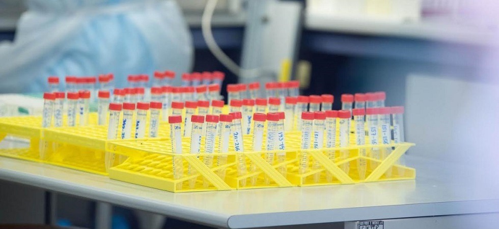 Coronavirus in Trentino, 2 morti e 44 positivi