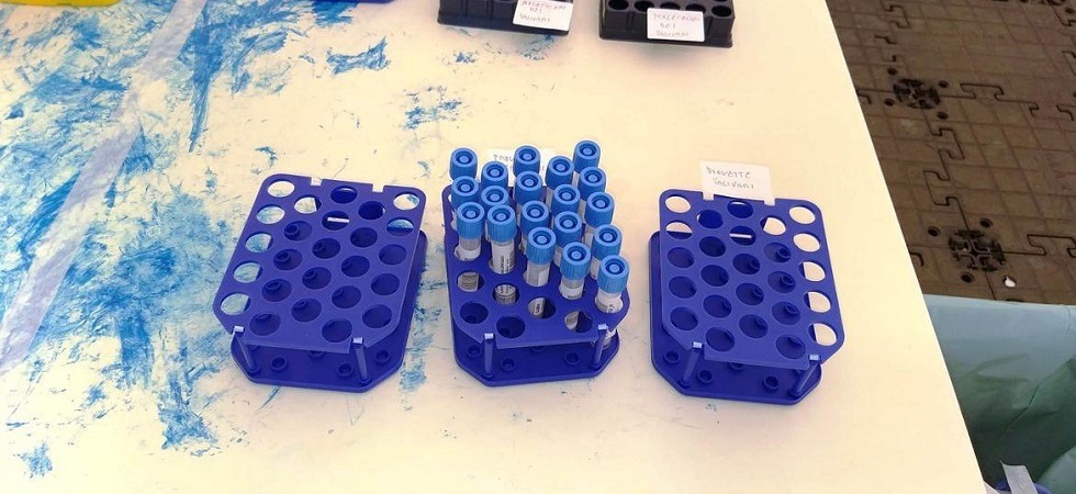 Covid, il Cibio: Con i test salivari tasso di positività nelle scuole negli ultimi giorni salito al 2%