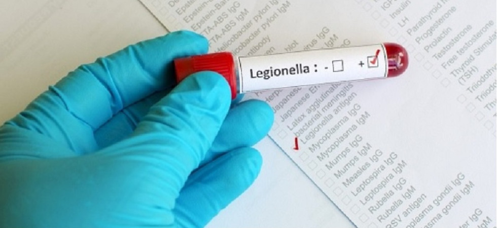 Legionella nel Bellunese, un paziente in terapia intensiva