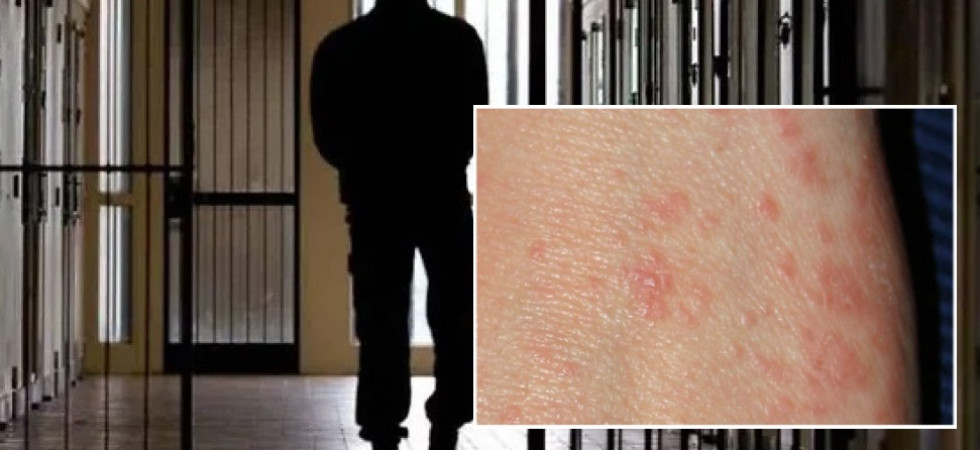 "Allarme scabbia" in carcere, già diversi detenuti contagiati, Sinappe: "Serve subito una disinfestazione"