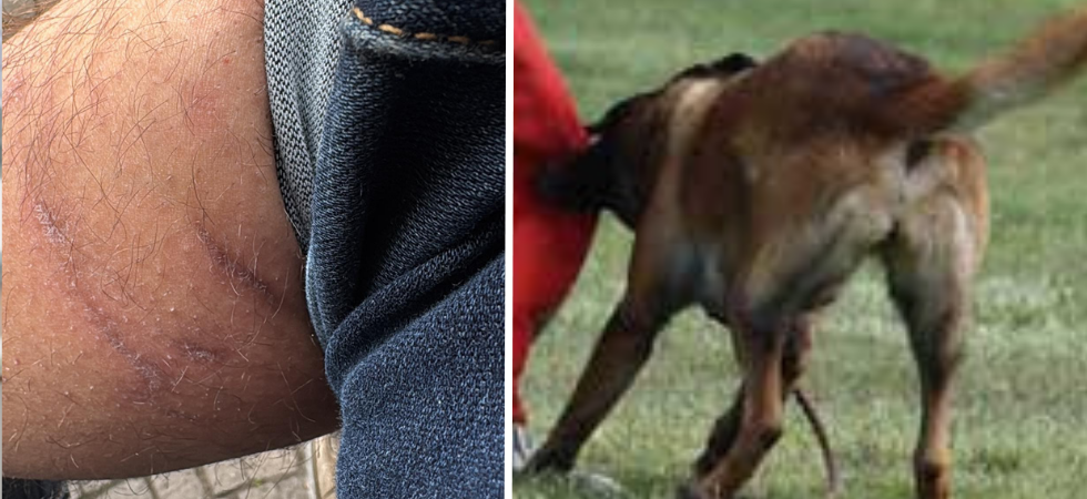 "Quel cane è fuori controllo e ha già fatto finire in ospedale due persone"