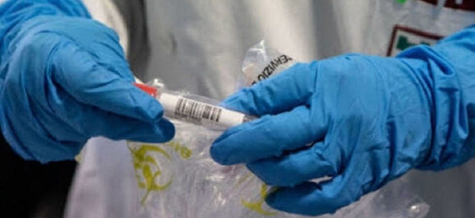 Ebola, dopo il caso sospetto in Trentino i risultati delle analisi: campione negativo