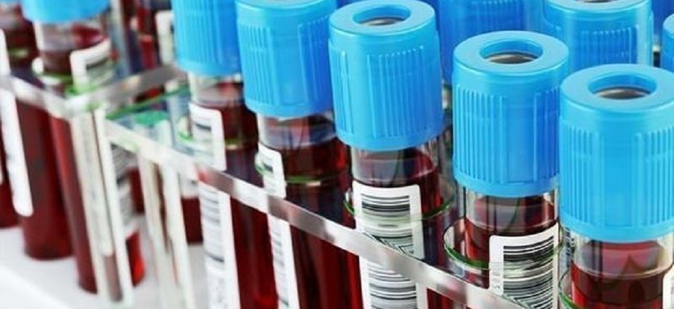 In stazione spunta un trolley pieno zeppo di provette di sangue: era stato rubato a un laboratorio di Padova