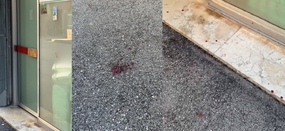 Mi ha aggredito in via Travai