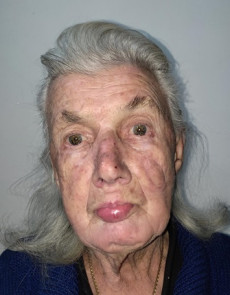 Anna Biasiolli